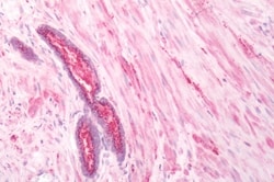 beta-3 Adrenergic Receptor Polyclonal Antibody:Antibodies, Polyclonal