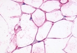 beta-3 Adrenergic Receptor Polyclonal Antibody:Antibodies, Polyclonal