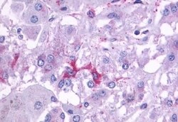 beta-3 Adrenergic Receptor Polyclonal Antibody:Antibodies, Polyclonal