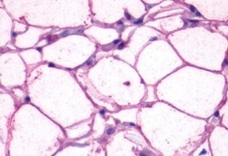 Invitrogen beta-3 Adrenergic Receptor Polyclonal Antibody 50 &mu;g; Unconjugated:Antibodies,