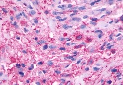 Invitrogen beta-3 Adrenergic Receptor Polyclonal Antibody 50 &mu;g; Unconjugated:Antibodies,