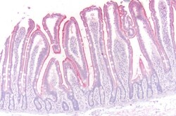 Invitrogen beta-3 Adrenergic Receptor Polyclonal Antibody 50 &mu;g; Unconjugated:Antibodies,