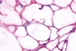Invitrogen beta-3 Adrenergic Receptor Polyclonal Antibody 50 &mu;g; Unconjugated:Antibodies,