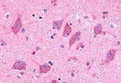 Invitrogen BAI2 Polyclonal Antibody 50 μg; Unconjugated:Antibodies,