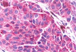 Invitrogen BAI3 Polyclonal Antibody 50 &mu;g | Buy Online | Invitrogen&trade; | Fisher Scientific