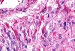 Invitrogen BAI3 Polyclonal Antibody 50 &mu;g | Buy Online | Invitrogen&trade; | Fisher Scientific