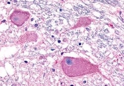 Invitrogen BAI3 Polyclonal Antibody 50 &mu;g | Buy Online | Invitrogen&trade; | Fisher Scientific