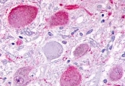 Invitrogen BAI3 Polyclonal Antibody 50 &mu;g; Unconjugated:Antibodies,