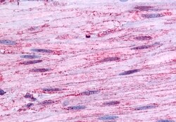 Invitrogen B1 Bradykinin Receptor Polyclonal Antibody 50 &mu;g; Unconjugated:Antibodies,