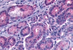 Invitrogen B1 Bradykinin Receptor Polyclonal Antibody 50 &mu;g; Unconjugated:Antibodies,