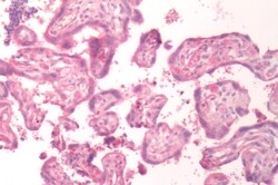 Invitrogen B1 Bradykinin Receptor Polyclonal Antibody 50 &mu;g; Unconjugated:Antibodies,
