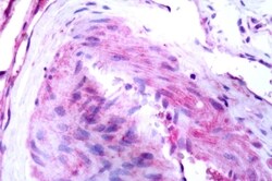 Invitrogen B1 Bradykinin Receptor Polyclonal Antibody 50 &mu;g; Unconjugated:Antibodies,