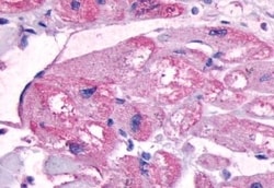 Invitrogen B1 Bradykinin Receptor Polyclonal Antibody 50 &mu;g; Unconjugated:Antibodies,