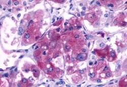 Invitrogen B1 Bradykinin Receptor Polyclonal Antibody 50 &mu;g; Unconjugated:Antibodies,