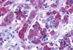 Invitrogen B1 Bradykinin Receptor Polyclonal Antibody 50 &mu;g; Unconjugated:Antibodies,