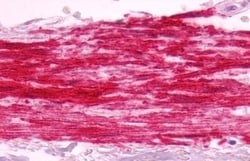 Invitrogen B1 Bradykinin Receptor Polyclonal Antibody 50 &mu;g; Unconjugated:Antibodies,