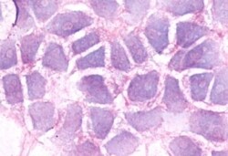 Invitrogen BDKRB2 Polyclonal Antibody 50 μg; Unconjugated:Antibodies,
