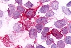 Invitrogen BDKRB2 Polyclonal Antibody 50 μg; Unconjugated:Antibodies,
