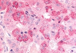 Invitrogen BDKRB2 Polyclonal Antibody 50 μg; Unconjugated:Antibodies,
