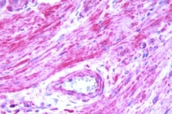 Invitrogen BDKRB2 Polyclonal Antibody 50 μg; Unconjugated:Antibodies,