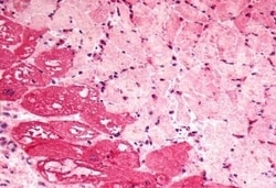 Invitrogen BDKRB2 Polyclonal Antibody 50 μg; Unconjugated:Antibodies,