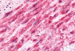 Invitrogen BDKRB2 Polyclonal Antibody 50 μg; Unconjugated:Antibodies,