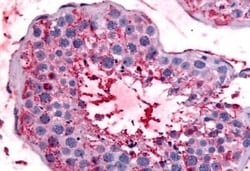 Invitrogen Bestrophin 2 Polyclonal Antibody 50 &mu;g; Unconjugated:Antibodies,