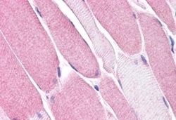 Invitrogen Bestrophin 3 Polyclonal Antibody 50 &mu;g; Unconjugated:Antibodies,