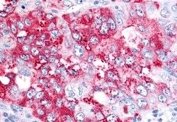 Invitrogen Bestrophin 4 Polyclonal Antibody 50 &mu;g | Buy Online | Invitrogen&trade; | Fisher Scientific