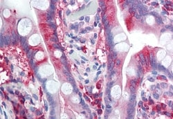 Invitrogen CaV1.2 Polyclonal Antibody 50 &mu;g; Unconjugated:Antibodies,