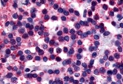 Invitrogen Calcitonin Receptor Polyclonal Antibody 50 &mu;g; Unconjugated:Antibodies,