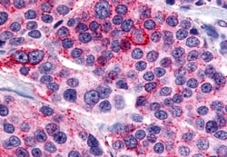Invitrogen Calcitonin Receptor Polyclonal Antibody 50 &mu;g; Unconjugated:Antibodies,