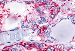 Invitrogen Calcitonin Receptor Polyclonal Antibody 50 μg; Unconjugated:Antibodies,