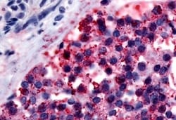 Invitrogen Calcitonin Receptor Polyclonal Antibody 50 μg; Unconjugated:Antibodies,