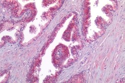Invitrogen CALCRL Polyclonal Antibody 50 μg; Unconjugated:Antibodies,