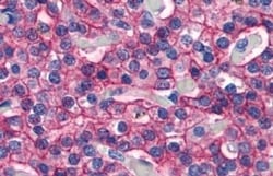 Invitrogen Calcium Sensing Receptor Polyclonal Antibody 50 &mu;g | Buy Online | Invitrogen&trade; | Fisher Scientific