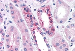 Invitrogen Calcium Sensing Receptor Polyclonal Antibody 50 &mu;g | Buy Online | Invitrogen&trade; | Fisher Scientific