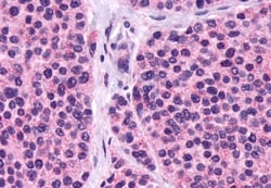 Invitrogen™ Calcium Sensing Receptor Polyclonal Antibody