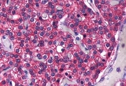 Invitrogen Calcium Sensing Receptor Polyclonal Antibody 50 &mu;g | Buy Online | Invitrogen&trade; | Fisher Scientific