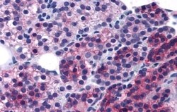 Invitrogen Calcium Sensing Receptor Polyclonal Antibody 50 &mu;g; Unconjugated:Antibodies,