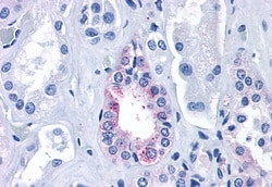 Invitrogen Calcium Sensing Receptor Polyclonal Antibody 50 &mu;g; Unconjugated:Antibodies,
