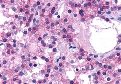 Invitrogen Calcium Sensing Receptor Polyclonal Antibody 50 &mu;g; Unconjugated:Antibodies,