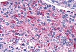 Invitrogen™ Calcium Sensing Receptor Polyclonal Antibody