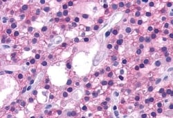 Invitrogen Calcium Sensing Receptor Polyclonal Antibody 50 &mu;g; Unconjugated:Antibodies,