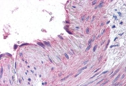 Invitrogen CCR1 Polyclonal Antibody 50 &mu;g; Unconjugated:Antibodies,