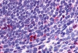 Invitrogen CCR2 Polyclonal Antibody 50 &mu;g; Unconjugated:Antibodies,