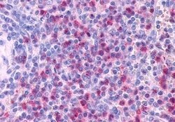 Invitrogen CCR3 Polyclonal Antibody 50 &mu;g | Buy Online | Invitrogen&trade; | Fisher Scientific