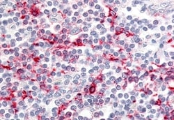 Invitrogen CCR6 Polyclonal Antibody 50 μg; Unconjugated:Antibodies,