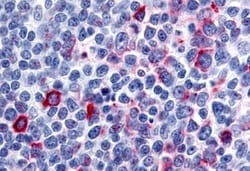 Invitrogen CCR8 Polyclonal Antibody 50 &mu;g; Unconjugated:Antibodies,