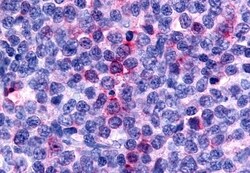Invitrogen CCR8 Polyclonal Antibody 50 &mu;g; Unconjugated:Antibodies,